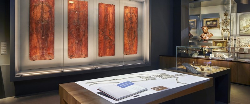 Evelyn Tables | Hunterian Museum